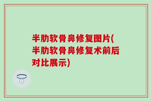 半肋软骨鼻修复图片(半肋软骨鼻修复术前后对比展示)