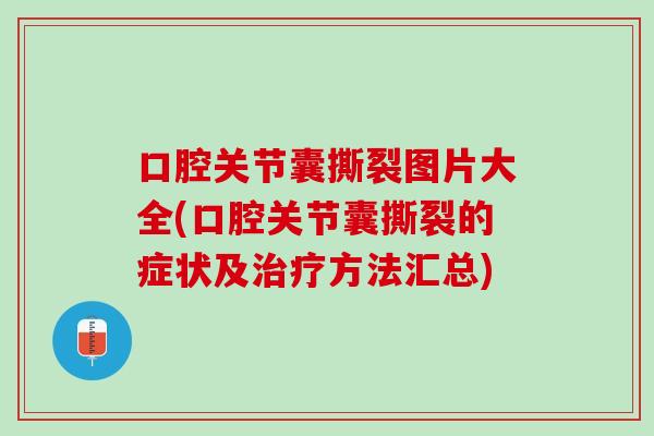 口腔关节囊撕裂图片大全(口腔关节囊撕裂的症状及治疗方法汇总)