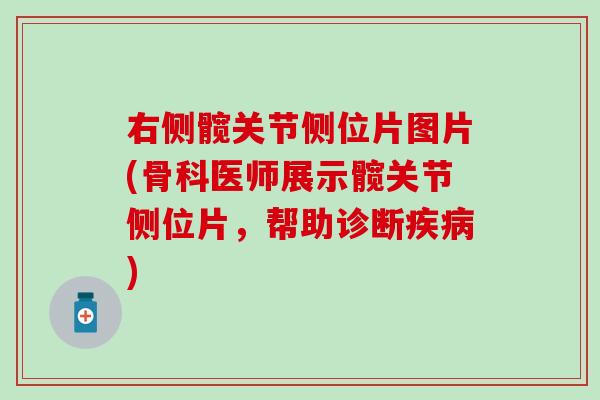 右侧髋关节侧位片图片(骨科医师展示髋关节侧位片，帮助诊断疾病)