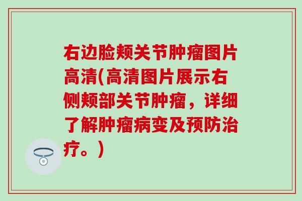右边脸颊关节肿瘤图片高清(高清图片展示右侧颊部关节肿瘤，详细了解肿瘤病变及预防治疗。)