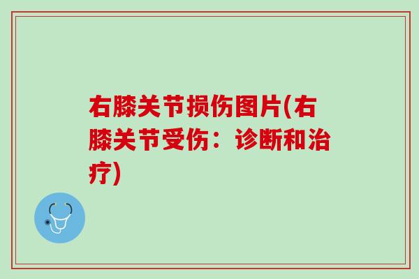 右膝关节损伤图片(右膝关节受伤:诊断和) 右膝关节损伤图片(右膝关节受伤:诊断和)