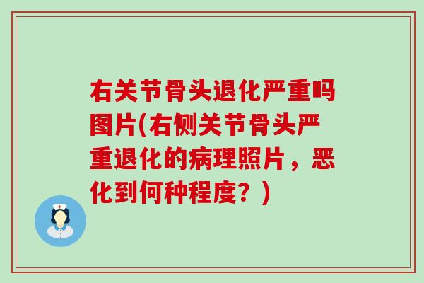 右关节骨头退化严重吗图片(右侧关节骨头严重退化的病理照片，恶化到何种程度？)