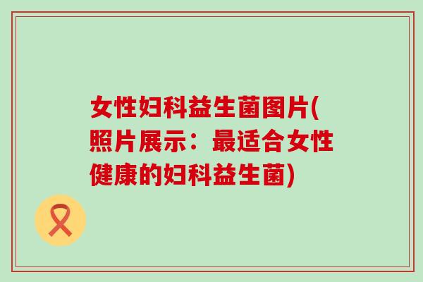 女性妇科益生菌图片(照片展示：最适合女性健康的妇科益生菌)