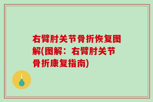 右臂肘关节骨折恢复图解(图解：右臂肘关节骨折康复指南)