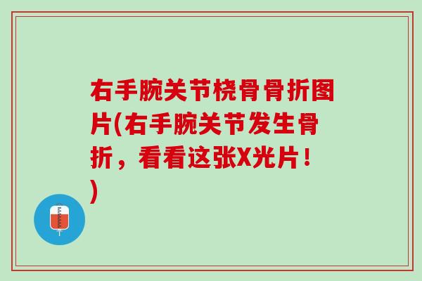 右手腕关节桡骨骨折图片(右手腕关节发生骨折，看看这张X光片！)