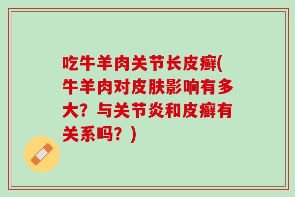 吃牛羊肉关节长皮癣(牛羊肉对影响有多大?与和皮癣有关系吗?) 吃牛羊肉关节长皮癣(牛羊肉对影响有多大?与和皮癣有关系吗?)