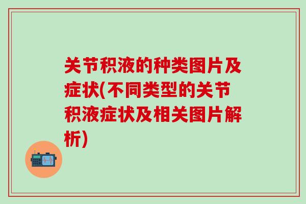 关节积液的种类图片及症状(不同类型的关节积液症状及相关图片解析)