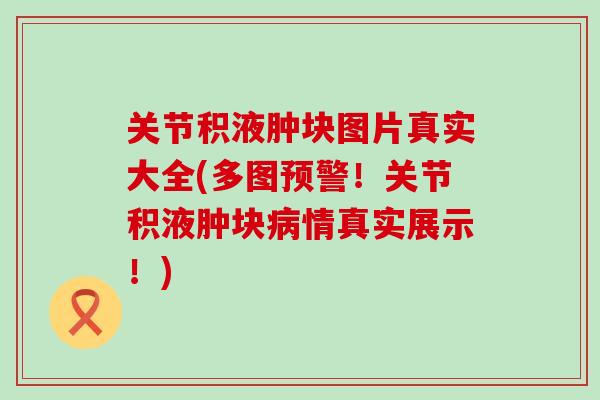 关节积液肿块图片真实大全(多图预警！关节积液肿块病情真实展示！)