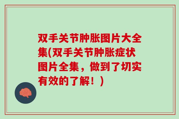 双手关节肿胀图片大全集(双手关节肿胀症状图片全集，做到了切实有效的了解！)