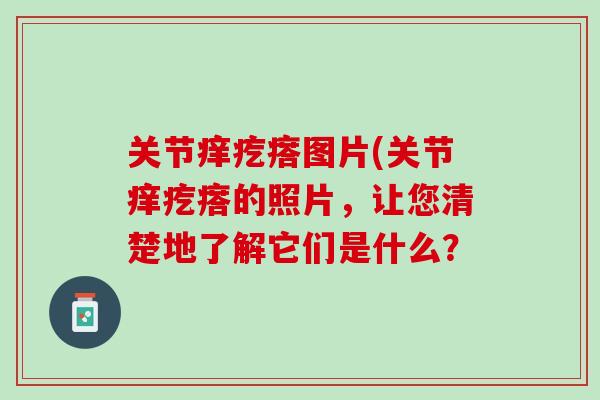 关节痒疙瘩图片(关节痒疙瘩的照片，让您清楚地了解它们是什么？