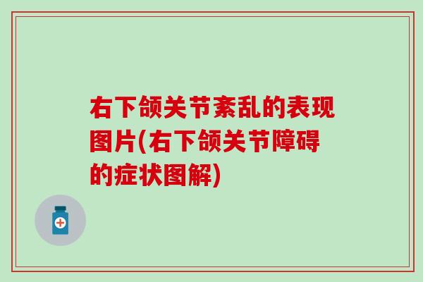 右下颌关节紊乱的表现图片(右下颌关节障碍的症状图解)