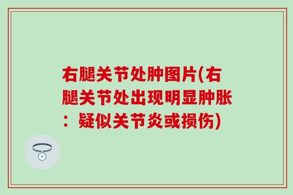 右腿关节处肿图片(右腿关节处出现明显肿胀：疑似关节炎或损伤)