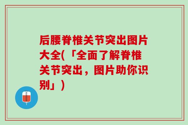 后腰脊椎关节突出图片大全(「全面了解脊椎关节突出，图片助你识别」)