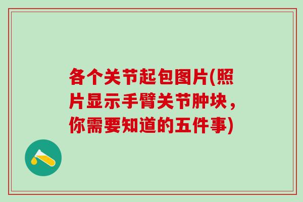 各个关节起包图片(照片显示手臂关节肿块，你需要知道的五件事)