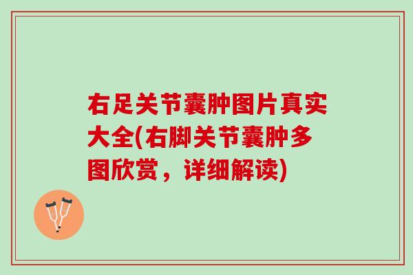 右足关节囊肿图片真实大全(右脚关节囊肿多图欣赏，详细解读)