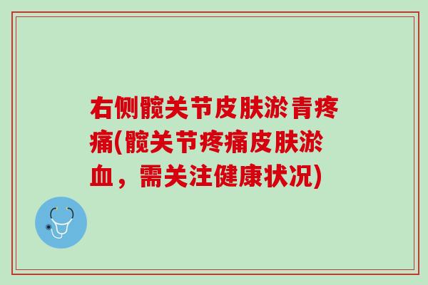 右侧髋关节皮肤淤青疼痛(髋关节疼痛皮肤淤血，需关注健康状况)