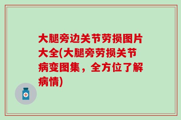 大腿旁边关节劳损图片大全(大腿旁劳损关节病变图集，全方位了解病情)