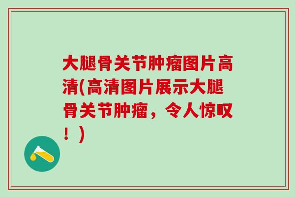 大腿骨关节肿瘤图片高清(高清图片展示大腿骨关节肿瘤，令人惊叹！)