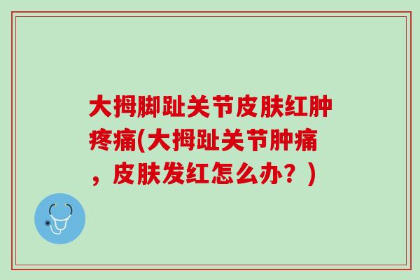 大拇脚趾关节皮肤红肿疼痛(大拇趾关节肿痛，皮肤发红怎么办？)