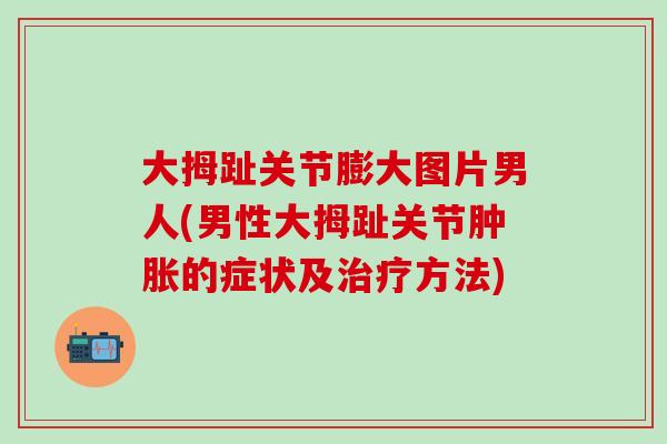 大拇趾关节膨大图片男人(男性大拇趾关节肿胀的症状及治疗方法)