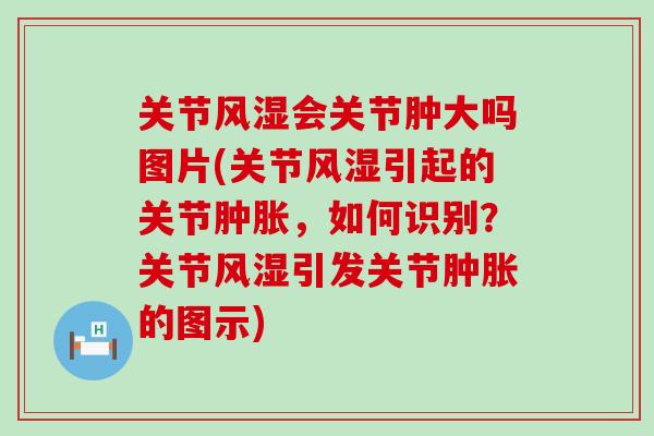 关节风湿会关节肿大吗图片(关节风湿引起的关节肿胀，如何识别？关节风湿引发关节肿胀的图示)