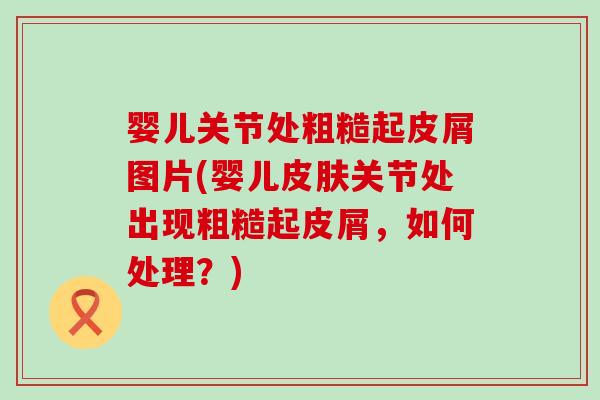 婴儿关节处粗糙起皮屑图片(婴儿皮肤关节处出现粗糙起皮屑，如何处理？)