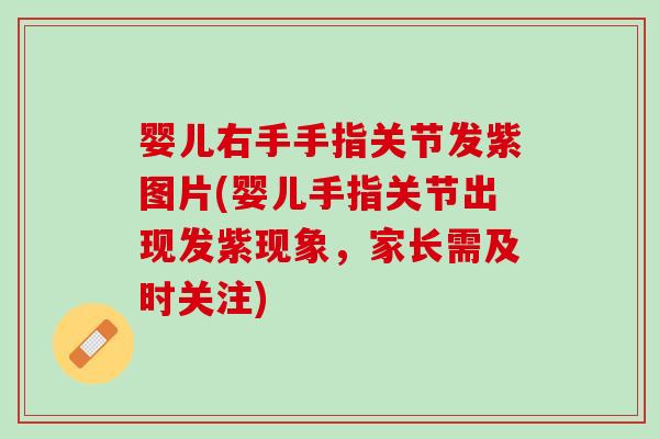 婴儿右手手指关节发紫图片(婴儿手指关节出现发紫现象，家长需及时关注)