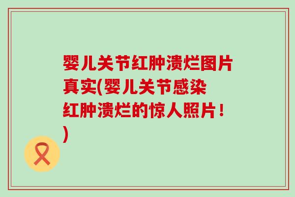 婴儿关节红肿溃烂图片真实(婴儿关节感染 红肿溃烂的惊人照片！)