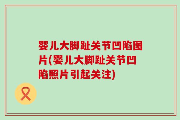 婴儿大脚趾关节凹陷图片(婴儿大脚趾关节凹陷照片引起关注)