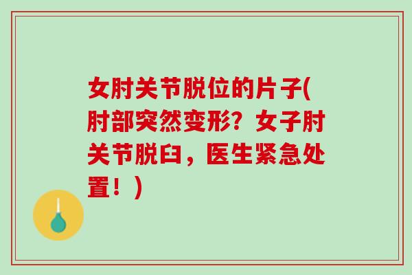 女肘关节脱位的片子(肘部突然变形？女子肘关节脱臼，医生紧急处置！)