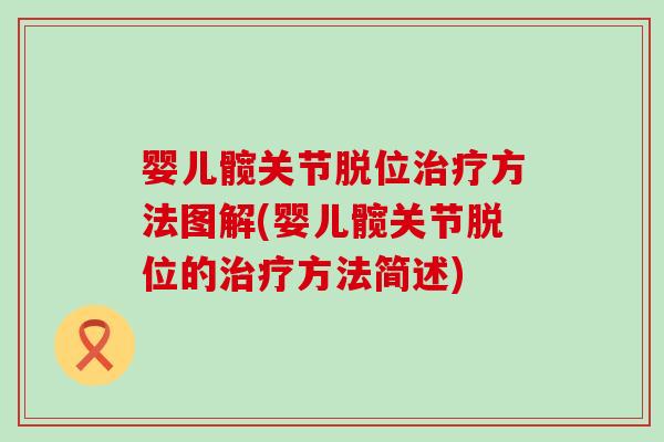 婴儿髋关节脱位治疗方法图解(婴儿髋关节脱位的治疗方法简述)