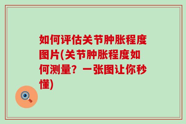 如何评估关节肿胀程度图片(关节肿胀程度如何测量？一张图让你秒懂)
