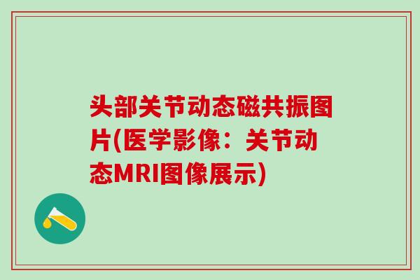 头部关节动态磁共振图片(医学影像：关节动态MRI图像展示)