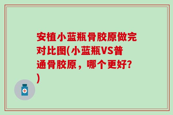 安植小蓝瓶骨胶原做完对比图(小蓝瓶VS普通骨胶原，哪个更好？)