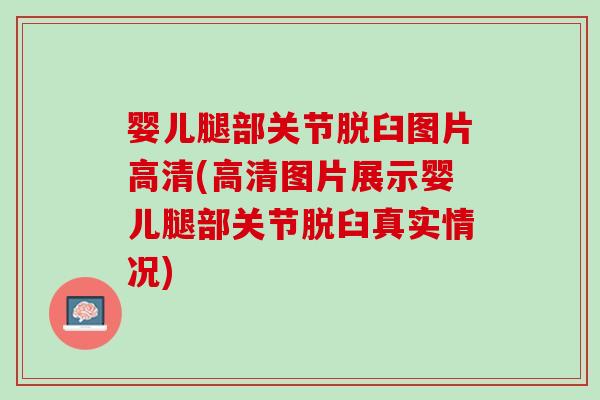婴儿腿部关节脱臼图片高清(高清图片展示婴儿腿部关节脱臼真实情况)