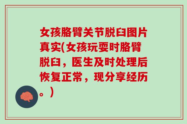 女孩胳臂关节脱臼图片真实(女孩玩耍时胳臂脱臼，医生及时处理后恢复正常，现分享经历。)