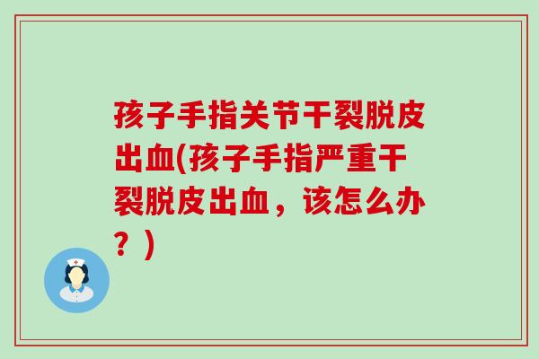 孩子手指关节干裂脱皮出血(孩子手指严重干裂脱皮出血，该怎么办？)