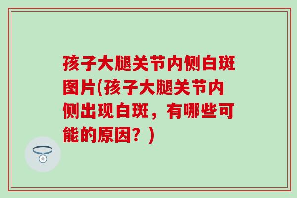 孩子大腿关节内侧白斑图片(孩子大腿关节内侧出现白斑，有哪些可能的原因？)