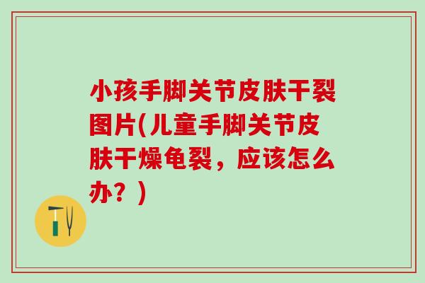 小孩手脚关节皮肤干裂图片(儿童手脚关节皮肤干燥龟裂，应该怎么办？)