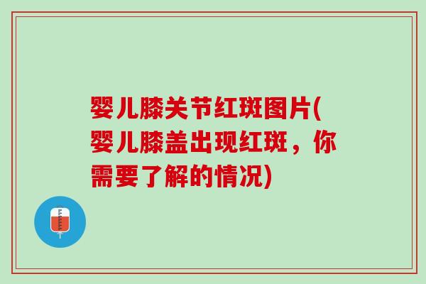 婴儿膝关节红斑图片(婴儿膝盖出现红斑，你需要了解的情况)