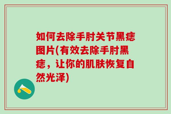 如何去除手肘关节黑痣图片(有效去除手肘黑痣，让你的肌肤恢复自然光泽)