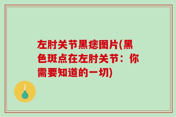 左肘关节黑痣图片(黑色斑点在左肘关节：你需要知道的一切)