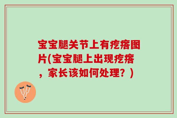 宝宝腿关节上有疙瘩图片(宝宝腿上出现疙瘩，家长该如何处理？)