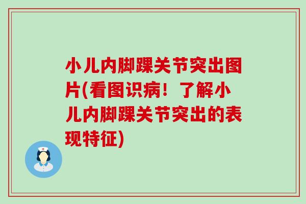 小儿内脚踝关节突出图片(看图识病！了解小儿内脚踝关节突出的表现特征)