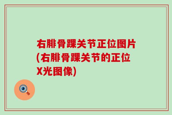 右腓骨踝关节正位图片(右腓骨踝关节的正位X光图像)