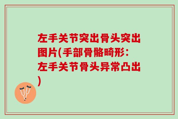 左手关节突出骨头突出图片(手部骨骼畸形：左手关节骨头异常凸出)