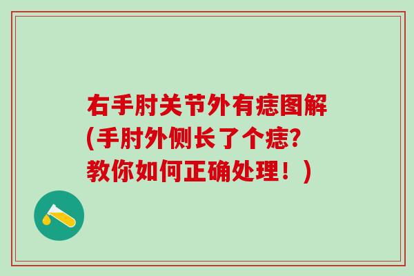 右手肘关节外有痣图解(手肘外侧长了个痣？教你如何正确处理！)