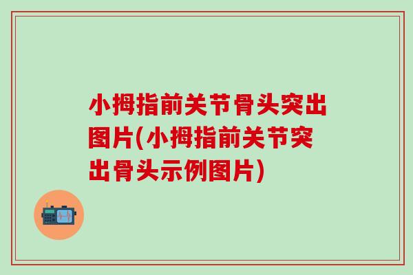 小拇指前关节骨头突出图片(小拇指前关节突出骨头示例图片)