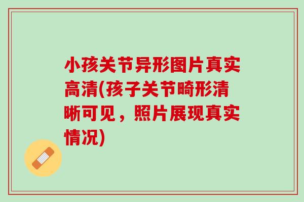 小孩关节异形图片真实高清(孩子关节畸形清晰可见，照片展现真实情况)