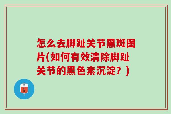 怎么去脚趾关节黑斑图片(如何有效清除脚趾关节的黑色素沉淀？)